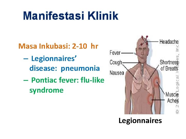 Manifestasi Klinik Masa Inkubasi: 2 -10 hr – Legionnaires’ disease: pneumonia – Pontiac fever: