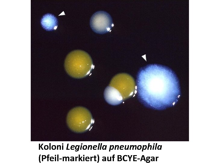 Koloni Legionella pneumophila (Pfeil-markiert) auf BCYE-Agar 