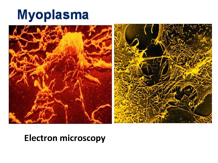 Myoplasma Electron microscopy 