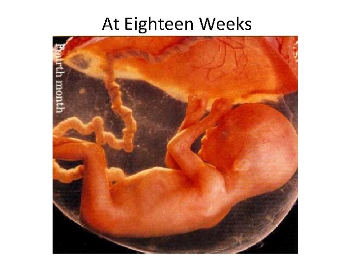 At Eighteen Weeks 