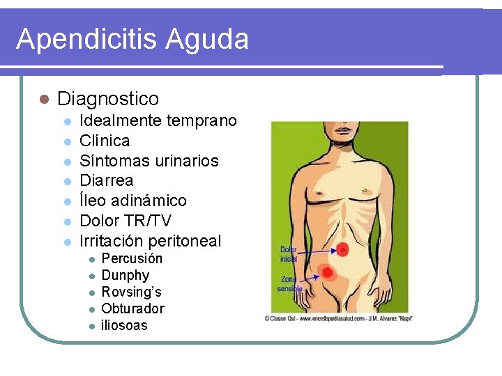 Apendicitis Aguda l Diagnostico l l l l Idealmente temprano Clínica Síntomas urinarios Diarrea