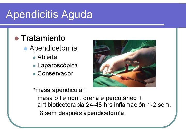 Apendicitis Aguda l Tratamiento l Apendicetomía Abierta l Laparoscópica l Conservador l *masa apendicular: