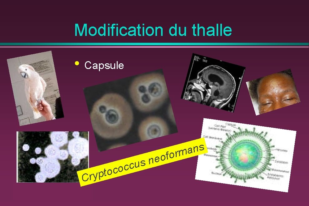 Modification du thalle • Capsule Cry c c o ptoc f o e us