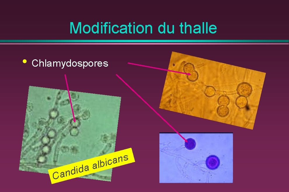 Modification du thalle • Chlamydospores a d i d Can s n a albic