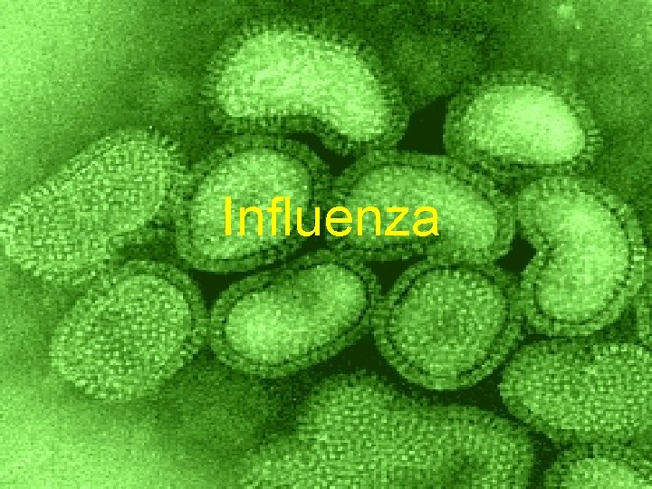 Influenza 