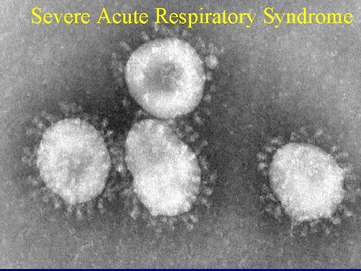 Severe Acute Respiratory Syndrome 