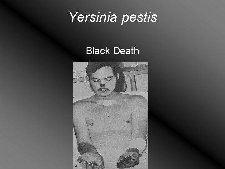 Yersinia pestis Black Death 