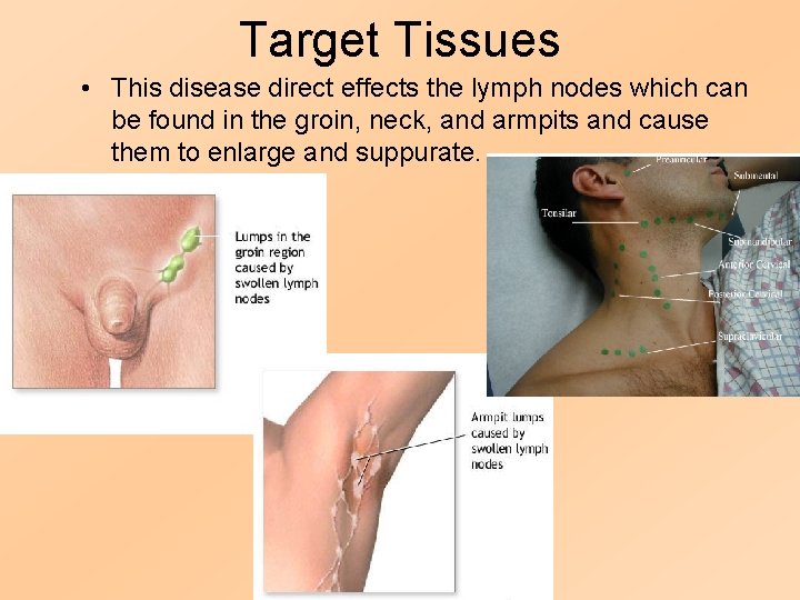 Target Tissues • This disease direct effects the lymph nodes which can be found