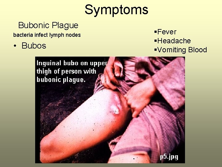 Symptoms Bubonic Plague bacteria infect lymph nodes • Bubos §Fever §Headache §Vomiting Blood 