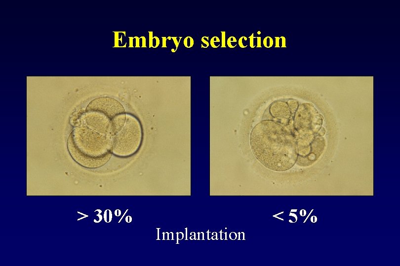 Embryo selection > 30% Implantation < 5% 