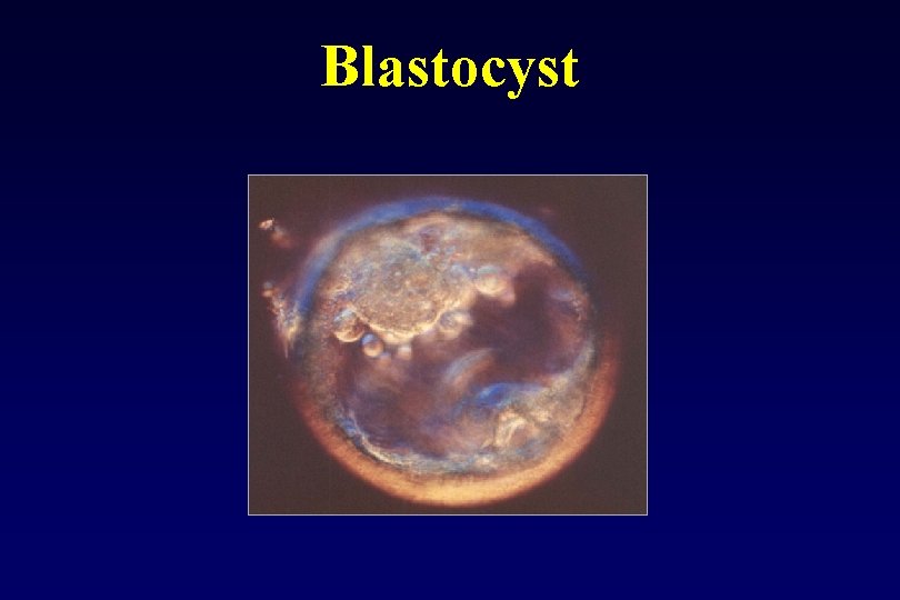 Blastocyst 