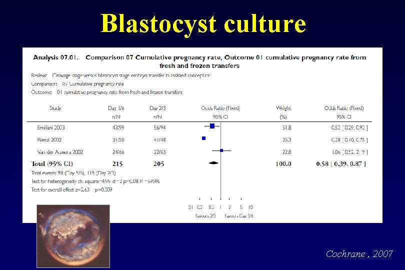 Blastocyst culture Cochrane , 2007 