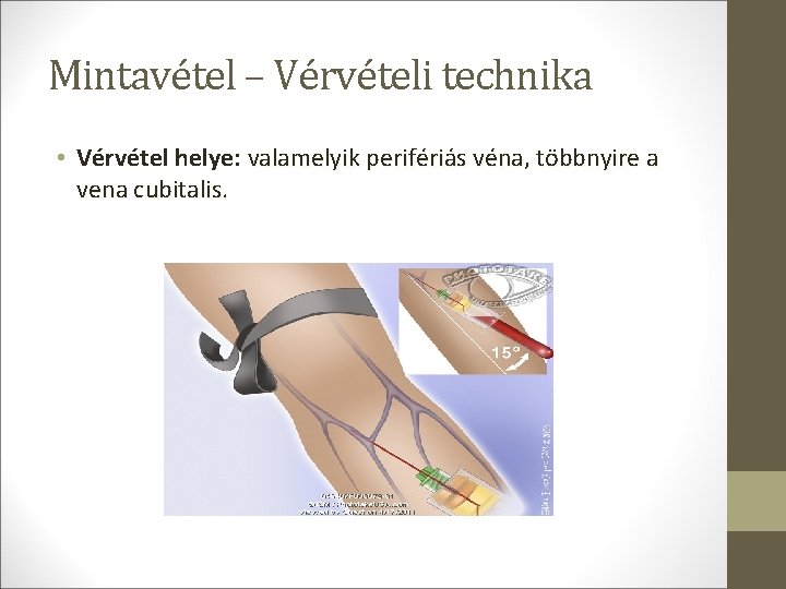 Mintavétel – Vérvételi technika • Vérvétel helye: valamelyik perifériás véna, többnyire a vena cubitalis.