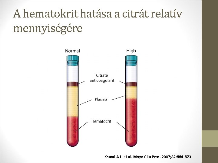 A hematokrit hatása a citrát relatív mennyiségére Kamal A H et al. Mayo Clin