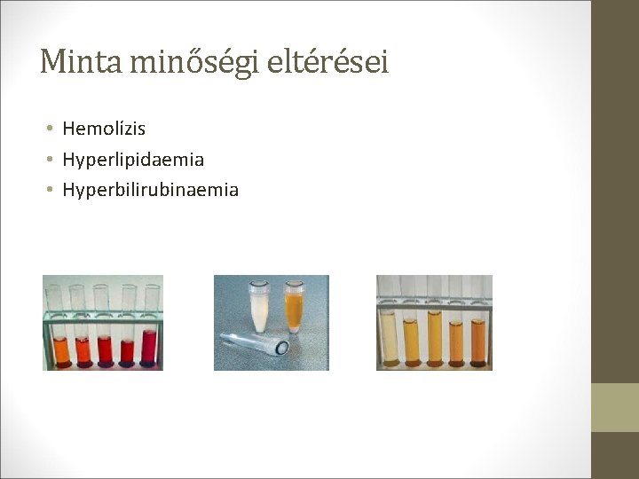 Minta minőségi eltérései • Hemolízis • Hyperlipidaemia • Hyperbilirubinaemia Minta minőségi eltérései • Hemolízis • Hyperlipidaemia • Hyperbilirubinaemia