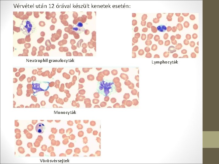 Vérvétel után 12 órával készült kenetek esetén: Neutrophil granulocyták Monocyták Vörösvérsejtek Lymphocyták 