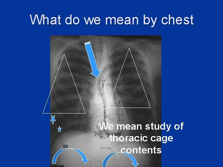 What do we mean by chest We mean study of thoracic cage contents 