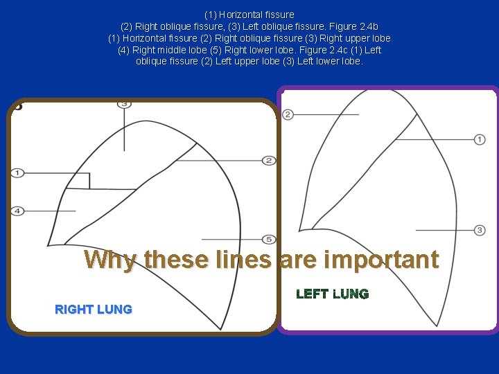 (1) Horizontal fissure (2) Right oblique fissure, (3) Left oblique fissure. Figure 2. 4