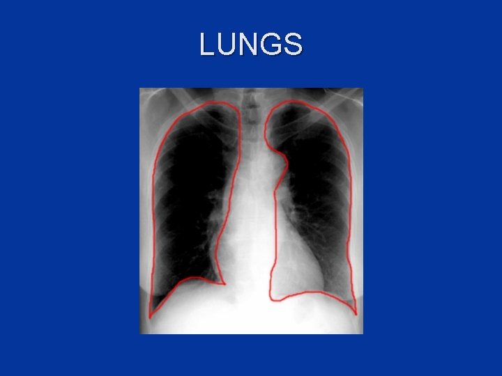 LUNGS 