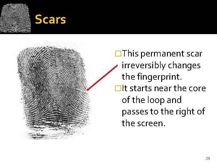 Scars �This permanent scar irreversibly changes the fingerprint. �It starts near the core of