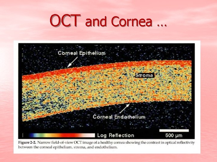 OCT and Cornea … 