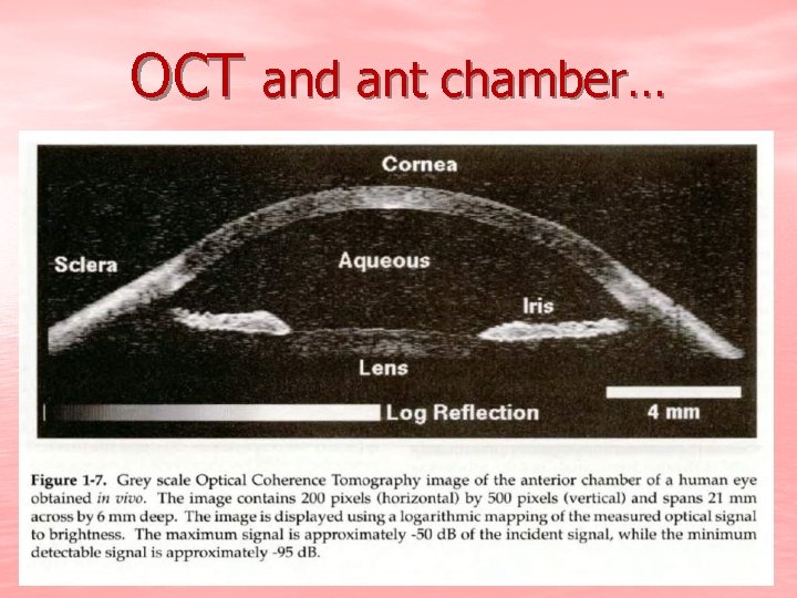 OCT and ant chamber… 