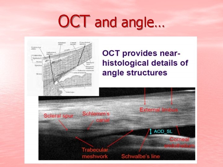 OCT and angle… 