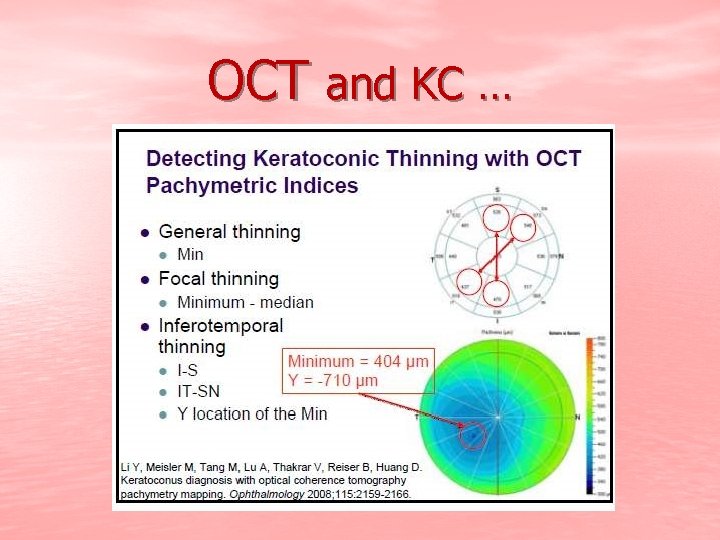 OCT and KC … 