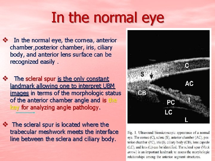 In the normal eye v In the normal eye, the cornea, anterior chamber, posterior