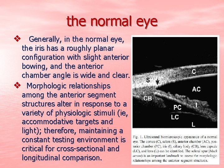 the normal eye v Generally, in the normal eye, the iris has a roughly