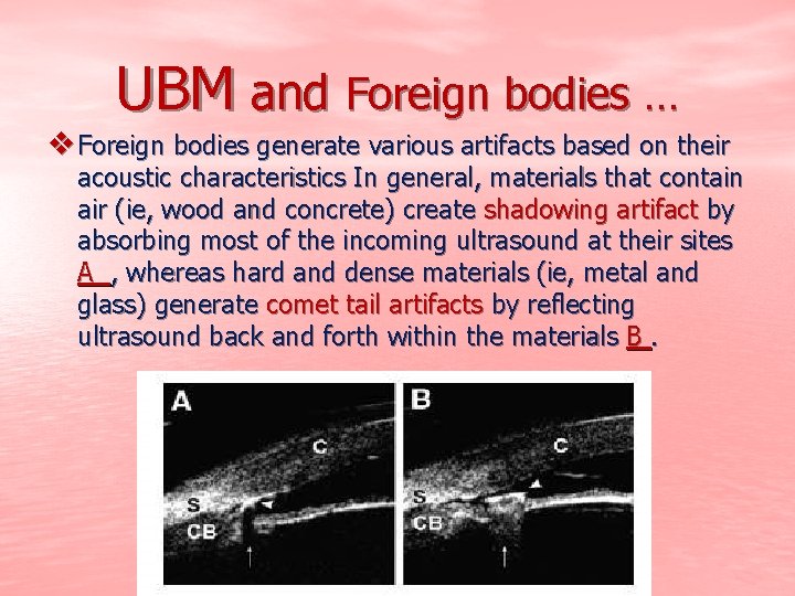UBM and Foreign bodies … v Foreign bodies generate various artifacts based on their