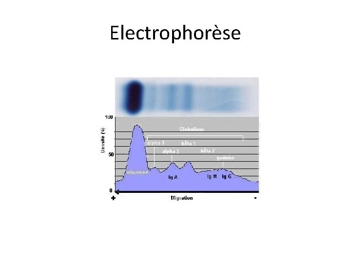 Electrophorèse 