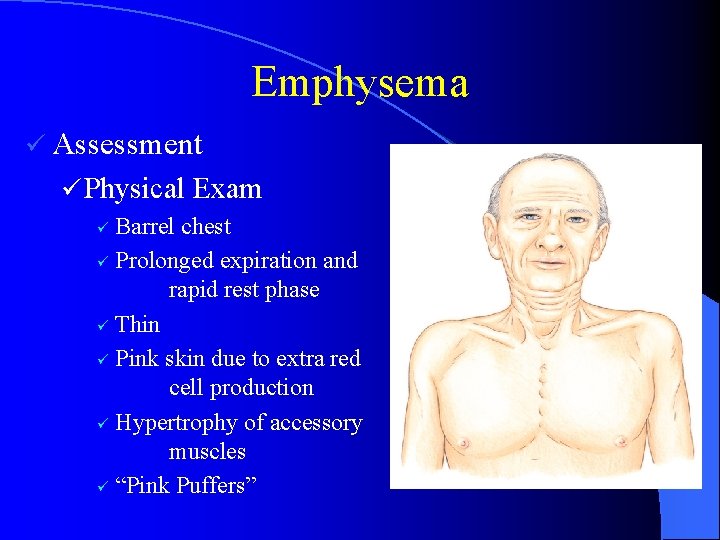 Emphysema ü Assessment ü Physical Exam Barrel chest ü Prolonged expiration and rapid rest
