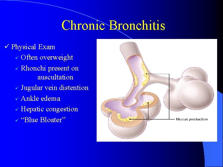 Chronic Bronchitis ü Physical Exam Often overweight ü Rhonchi present on auscultation ü Jugular