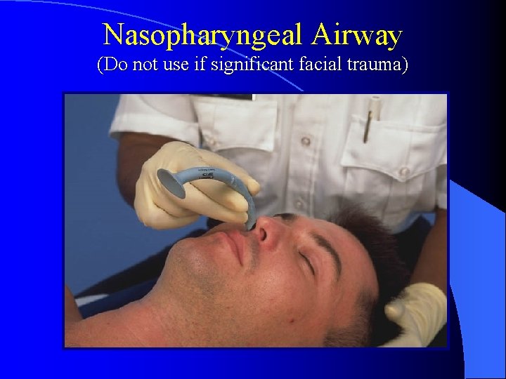 Nasopharyngeal Airway (Do not use if significant facial trauma) 