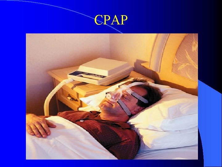 CPAP 
