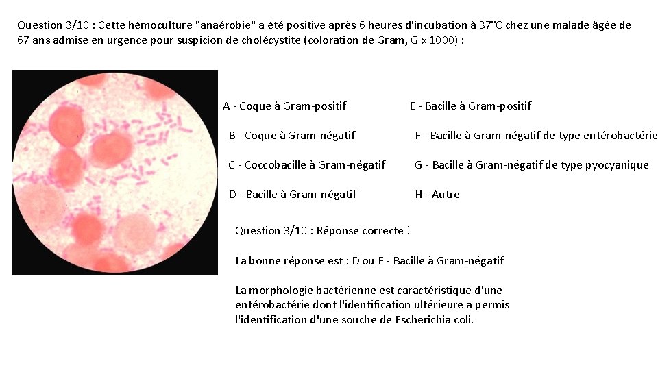 Question 3/10 : Cette hémoculture "anaérobie" a été positive après 6 heures d'incubation à