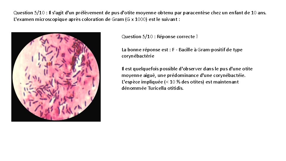 Question 5/10 : Il s'agit d'un prélèvement de pus d'otite moyenne obtenu paracentèse chez