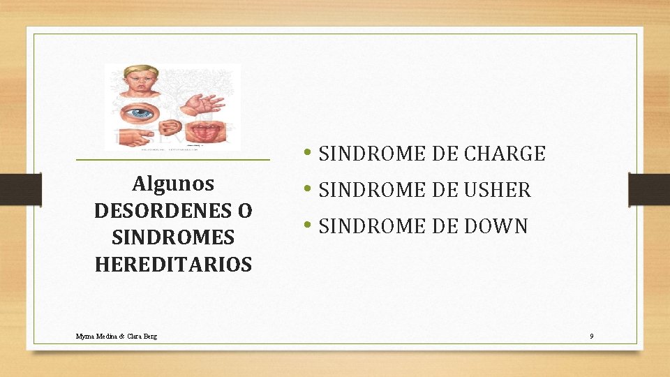 Algunos DESORDENES O SINDROMES HEREDITARIOS Myrna Medina & Clara Berg • SINDROME DE CHARGE