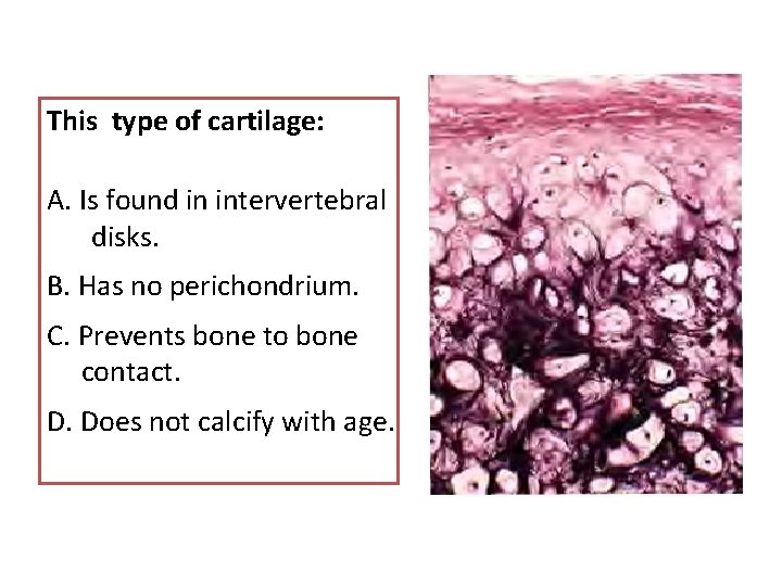 This type of cartilage: A. Is found in intervertebral disks. B. Has no perichondrium.