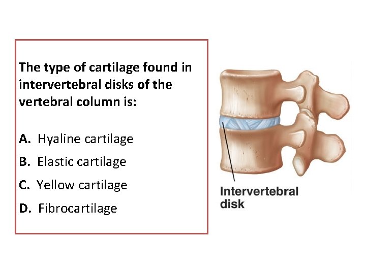 The type of cartilage found in intervertebral disks of the vertebral column is: A.