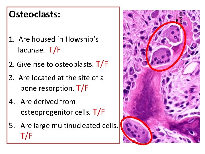 Osteoclasts: 1. Are housed in Howship’s lacunae. T/F 2. Give rise to osteoblasts. T/F