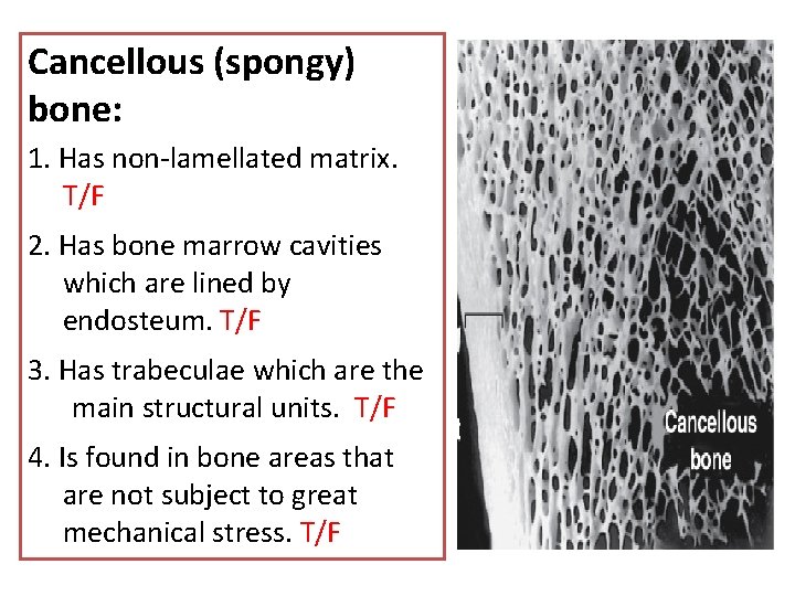 Cancellous (spongy) bone: 1. Has non‐lamellated matrix. T/F 2. Has bone marrow cavities which