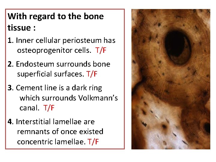With regard to the bone tissue : 1. Inner cellular periosteum has osteoprogenitor cells.