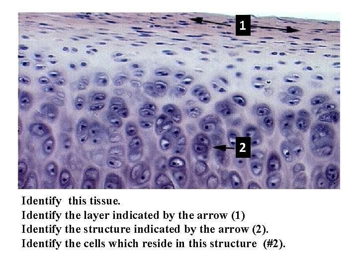 1 2 Identify this tissue. Identify the layer indicated by the arrow (1) Identify