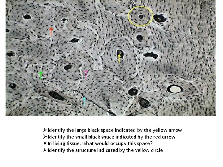 ØIdentify the large black space indicated by the yellow arrow ØIdentify the small black