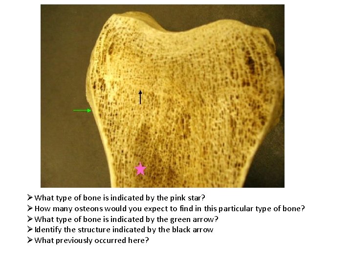 ØWhat type of bone is indicated by the pink star? ØHow many osteons would