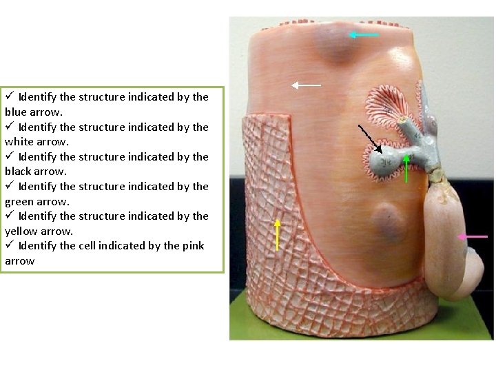 ü Identify the structure indicated by the blue arrow. ü Identify the structure indicated