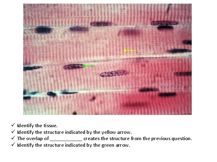 ü Identify the tissue. ü Identify the structure indicated by the yellow arrow. ü