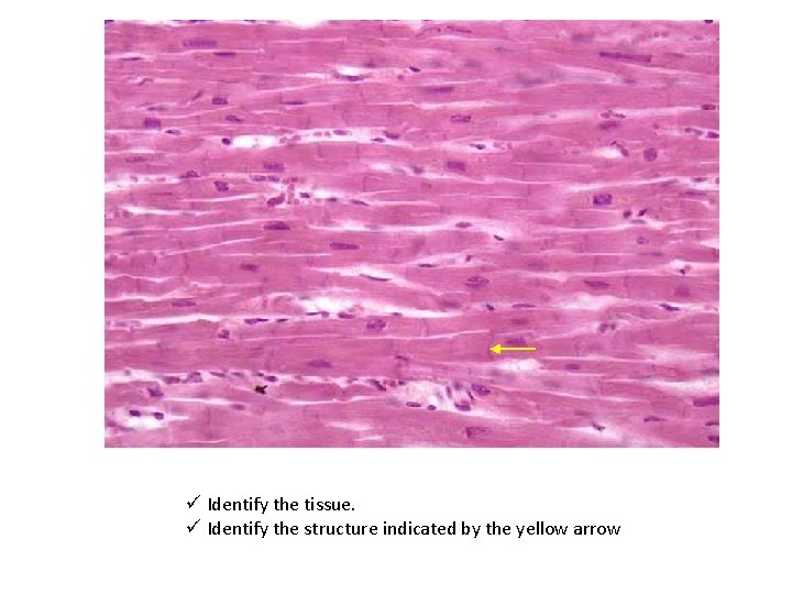 ü Identify the tissue. ü Identify the structure indicated by the yellow arrow 